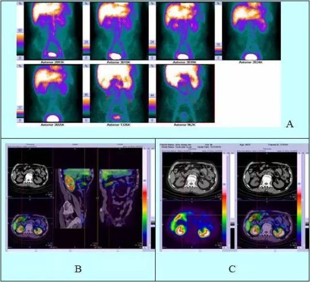 伟大的巴克·霍华德 视频缩略图