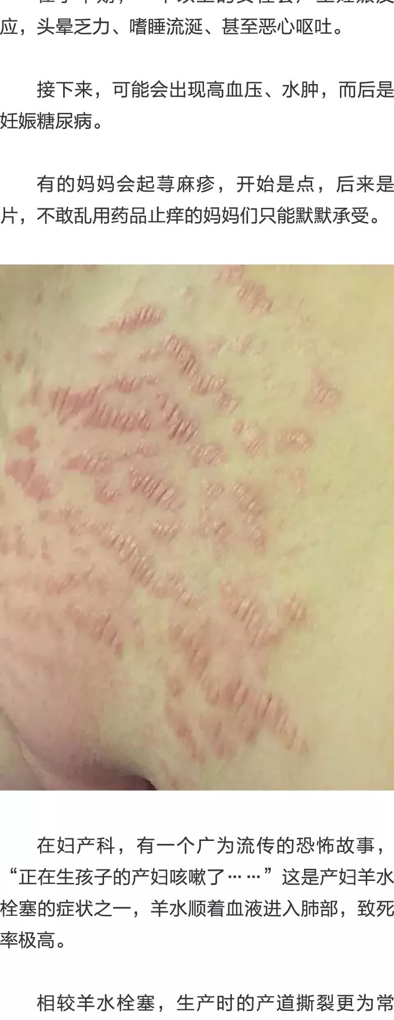 X战警：第一战（原声版）